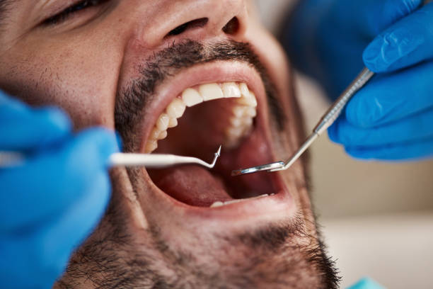 Best Emergency Treatment for Toothache in Mayodan, NC